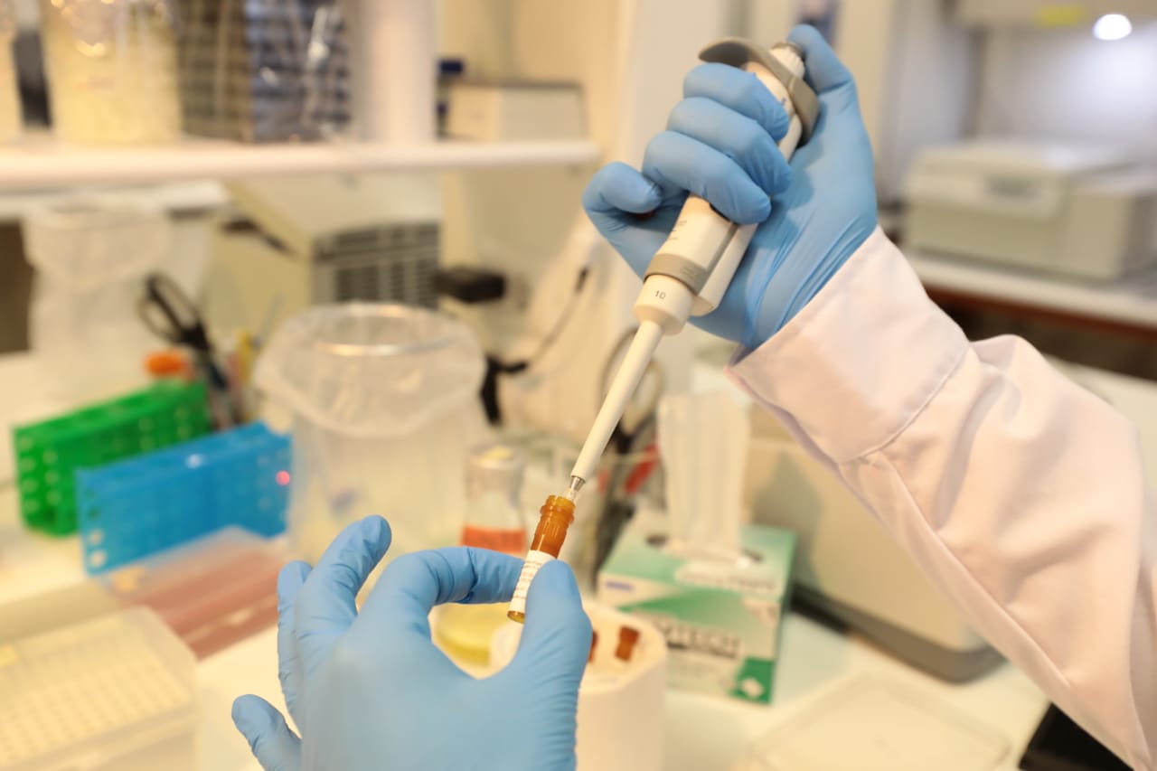 Essalud - EsSalud destaca y apoya investigación de universidad Cayetano Heredia para elaborar prueba molecular con resultados en 40 minutos Essalud - EsSalud destaca y apoya investigación de universidad Cayetano Heredia para elaborar prueba molecular con resultados en 40 minutos