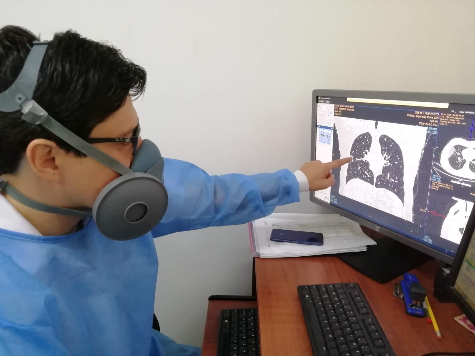 EsSalud Huánuco amplía a 13 las especialidades médicas que atenderán mediante teleconsultas