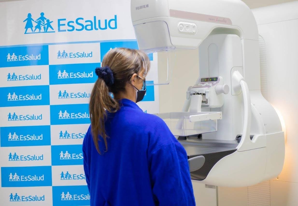 EsSalud Arequipa presenta moderno mamógrafo   