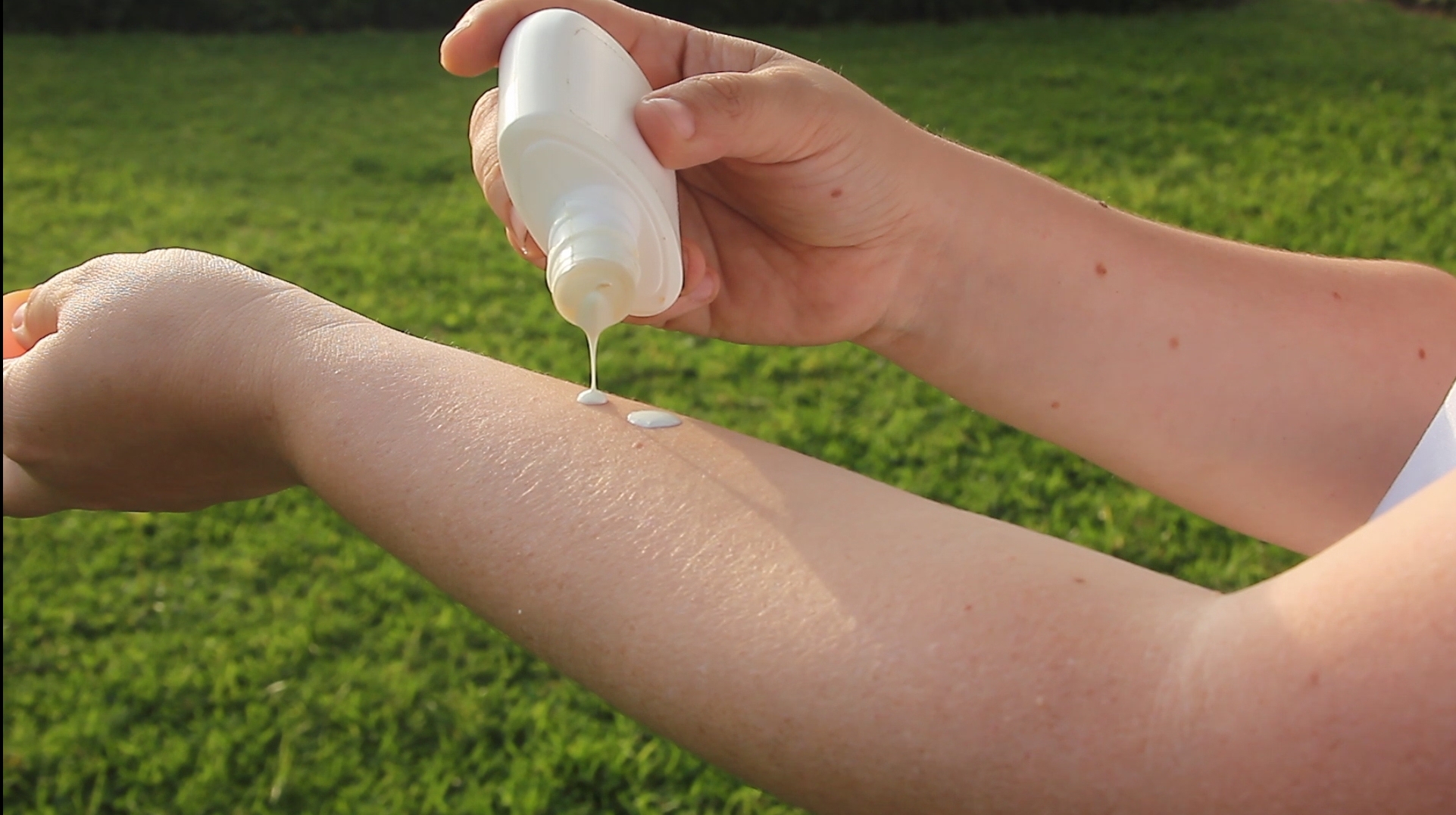 Essalud - EsSalud recomienda evitar sobreexposición al sol al detectar más de 200 lesiones a la piel asociadas con cáncer