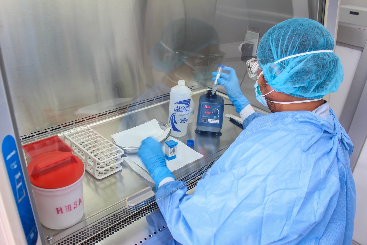 Essalud - EsSalud: Hospital III Suárez Angamos procesará 500 pruebas moleculares al mes para detectar COVID-19