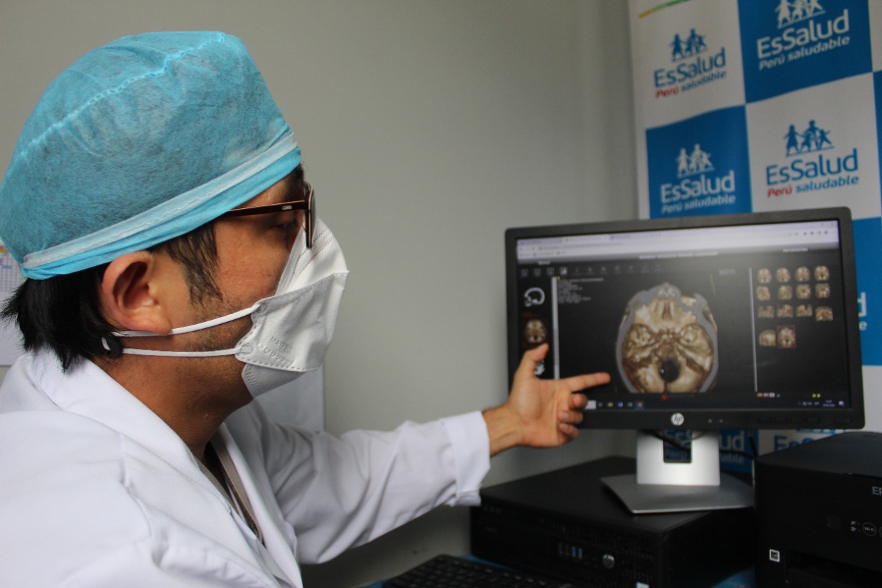 Essalud - EsSalud: Salvan la vida de paciente con malformación cerebral en hospital Sabogal