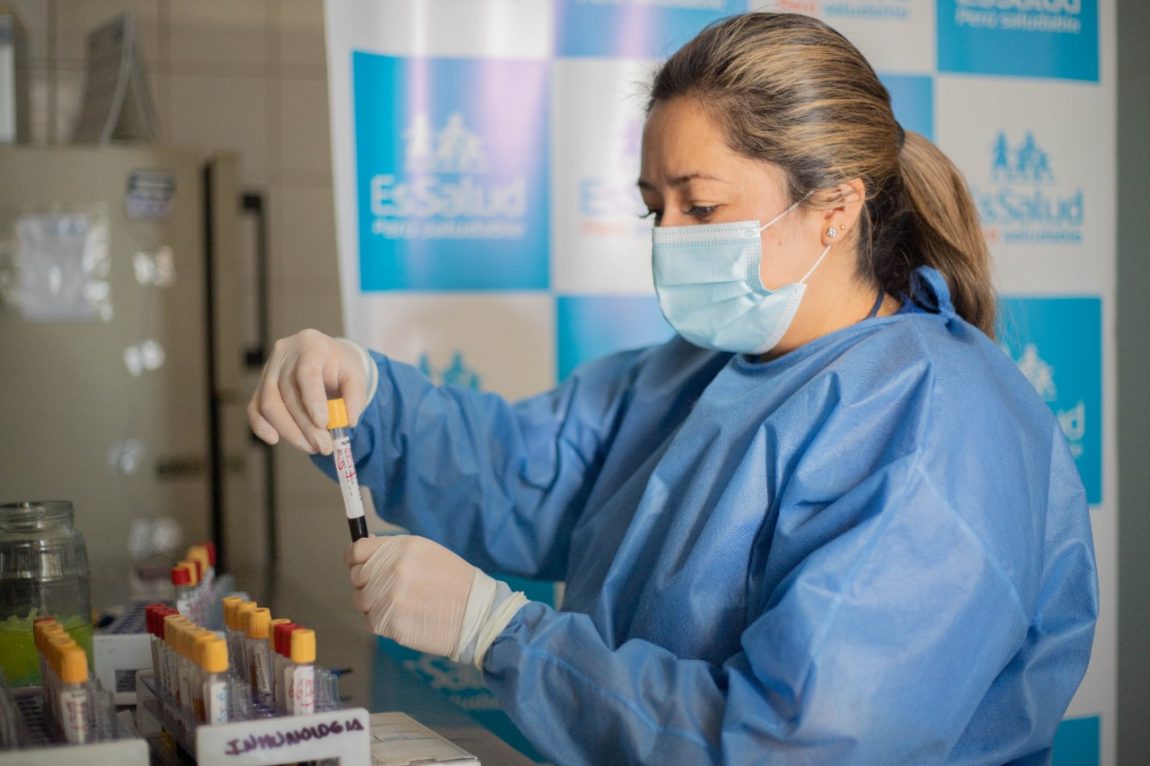 Essalud - EsSalud Arequipa destaca aplicación de prueba rápida del VIH para un tratamiento oportuno