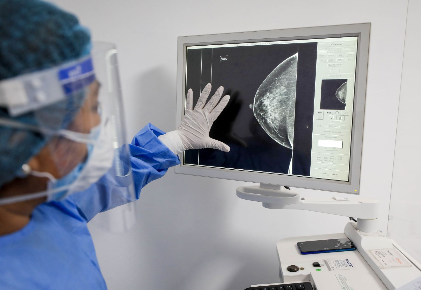EsSalud brindó más de 210 mil exámenes preventivos de cáncer ginecológico en primer semestre del 2022