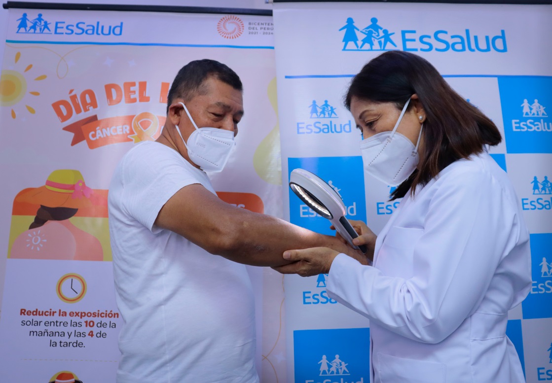 Essalud - EsSalud Piura: Hospital II Jorge Reátegui Delgado realizó cerca de 140 atenciones en campaña gratuita contra cáncer de piel