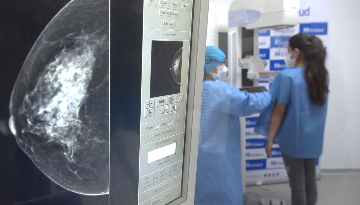 Essalud - EsSalud realiza más de 14 000 procedimientos oncológicos en su centro preventivo Alfredo Piazza de Lince