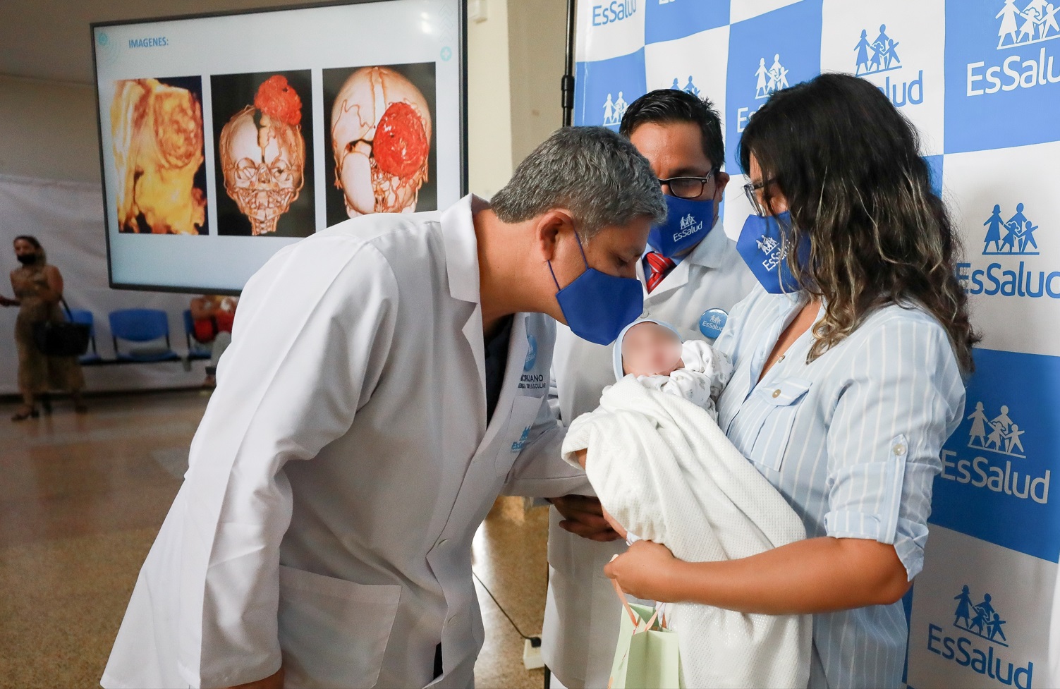 Médicos De Essalud Salvan La Vida A Bebé Que Nació Con Un Tumor Gigante En La Cabeza Essalud 6675